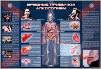 Электрифицированный стенд "Вредные привычки: алкоголизм" - «globural.ru» - Всеволожск