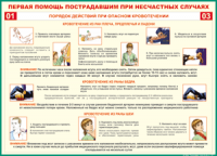 Таблица Порядок действий при опасном кровотечении 1000*1400 винил - «globural.ru» - Всеволожск